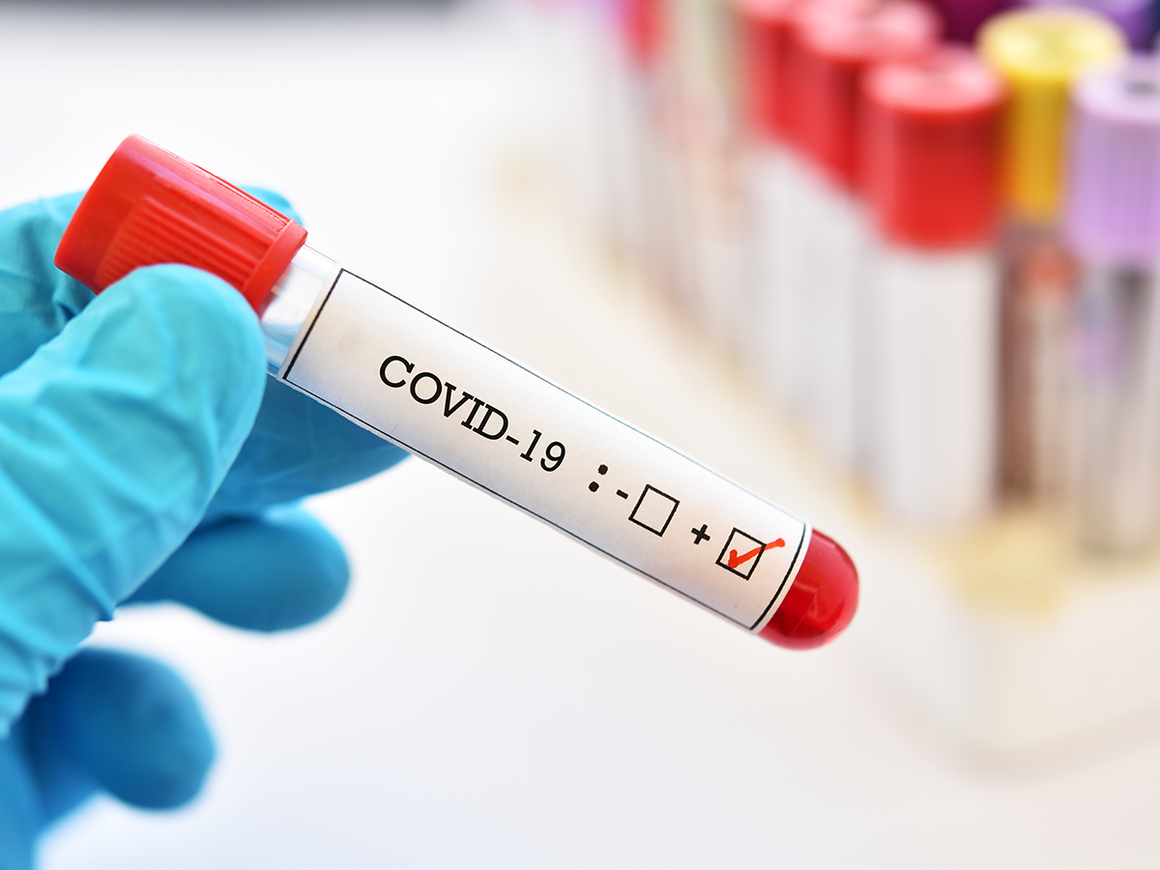  Medicii de familie solicită decontarea testelor pentru Covid