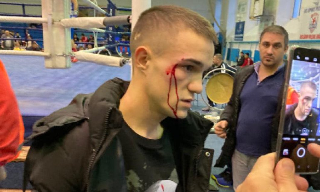  VIDEO: Boxer lovit de antrenor după ce a câștigat titlul național. Are arcada spartă