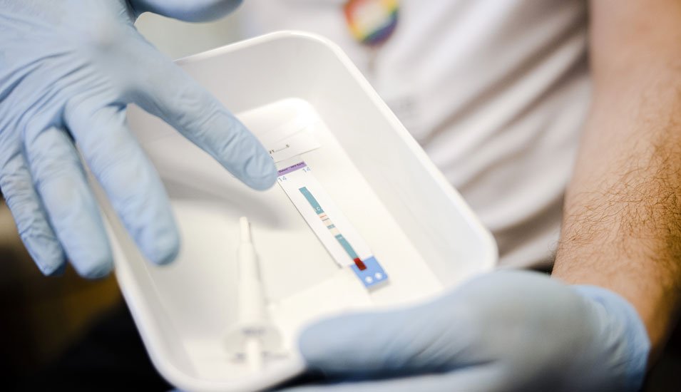  O nouă variantă HIV, mai virulentă, identificată în Olanda