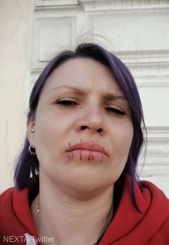  O activistă rusă şi-a cusut gura în semn de protest faţă de războiul din Ucraina