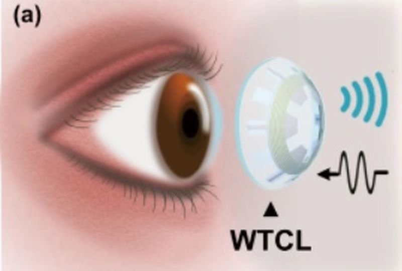  Lentile de contact inteligente care tratează glaucomul