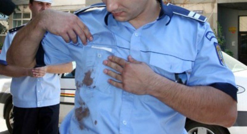  EXCLUSIV Comisar de poliție lovit cu capul în gură într-un parc de joacă din Iași. Poliția caută un individ