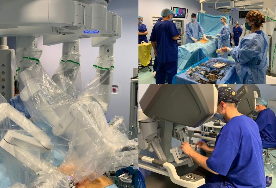  Prima operaţie asistată robotic din Moldova. A fost realizată la un pacient bolnav de cancer la colon