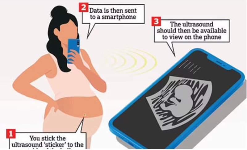  Femeile însărcinate și-ar putea vedea bebelușul crescând în burtică direct de pe telefon. Aplicația este în teste