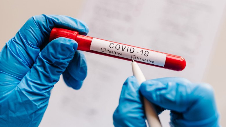  Scade numărul infectărilor COVID la Iaşi. Medicii se aşteaptă să urmeze creşteri. Se testează tot mai puţin