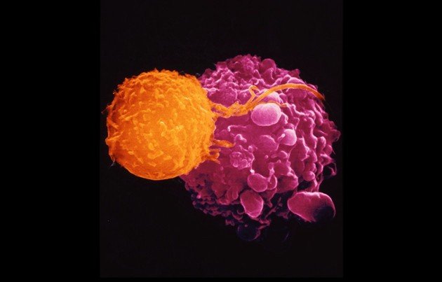  Un virus capabil să distrugă cancerul a furnizat rezultate promiţătoare în primele teste realizate pe oameni