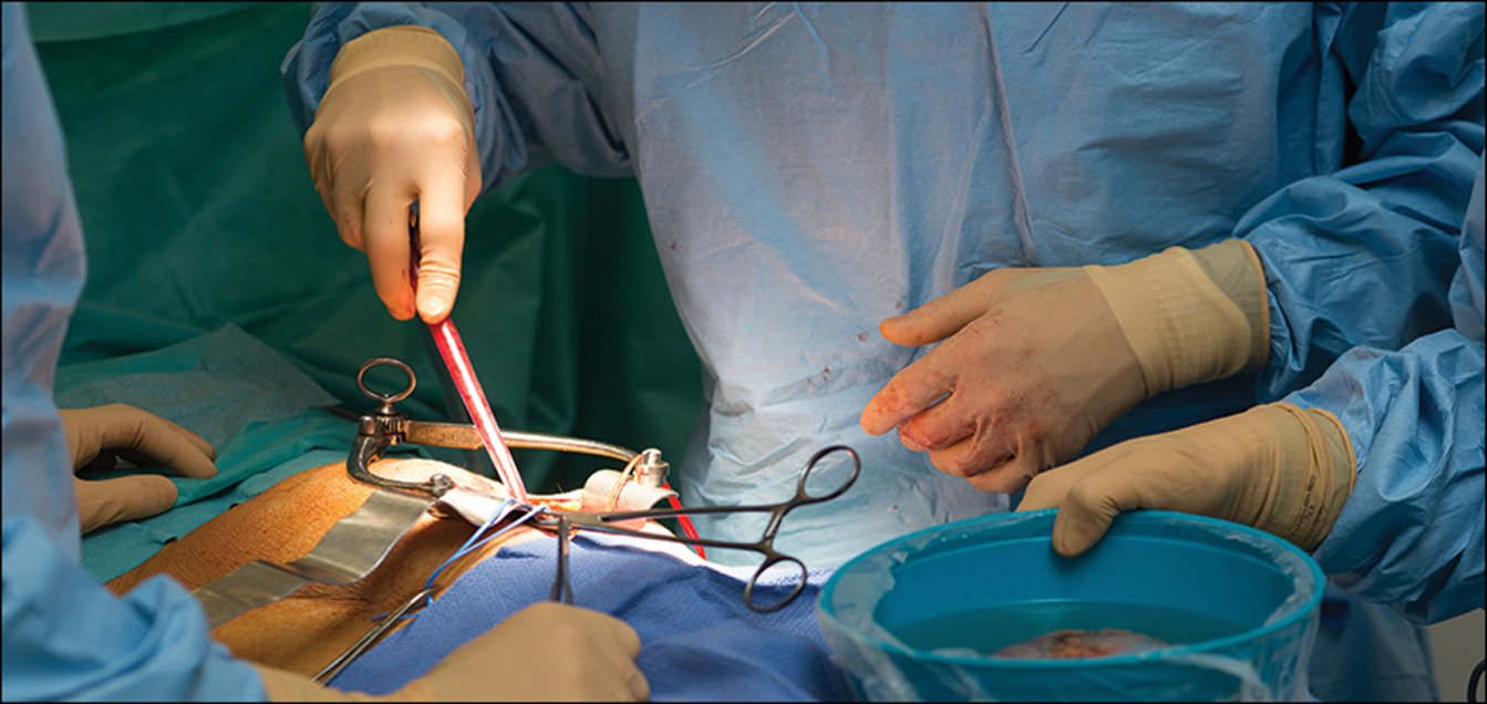  Încă o prelevare de organe la Spitalul de Neurochirurgie: rinichii au rămas la Iaşi, ficatul a fost transplantat la Bucureşti