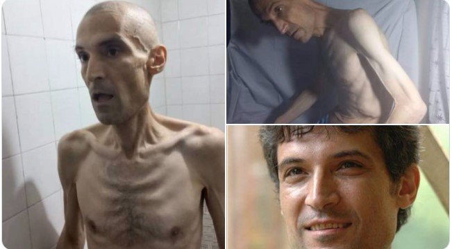  Imagini care stârnesc indignare: Un deţinut iranian a slăbit 52 kg şi a ajus numai piele şi os!