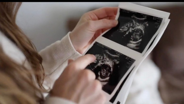  SUA: O femeie care nu are dreptul la avort își va vedea copilul murind la câteva ore după naștere