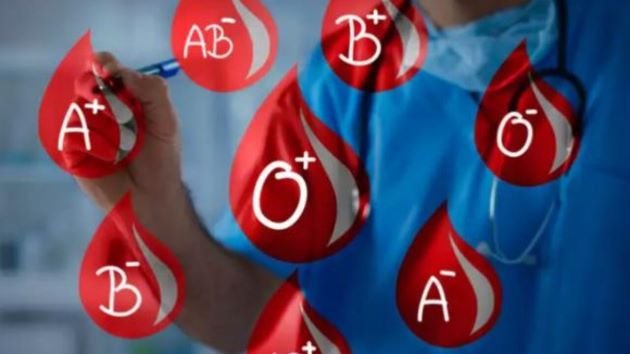  Persoanele cu grupa de sânge A ar putea avea un risc mai mare de AVC înainte de 60 de ani