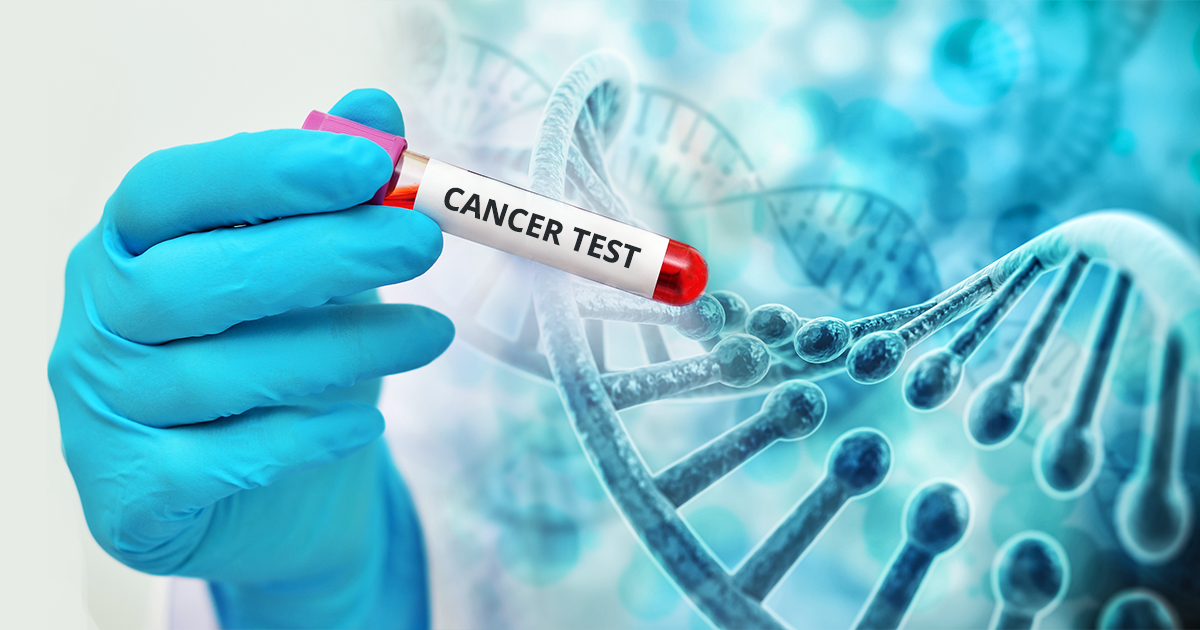  Teste efectuate de specialiştii IRO pentru depistarea cancerului, în această duminică în Rediu
