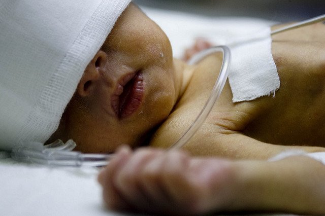  Bebeluşul ajuns în mai în stop cardiac, malnutrit şi deshidratat, la Spitalul de Pediatrie Ploieşti şi-a revenit