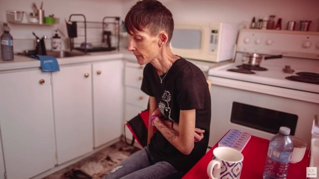  Povestea tulburâtoare a Lisei Pauli, anorexică, 47 de ani, care a cerut să fie ajutată să moară