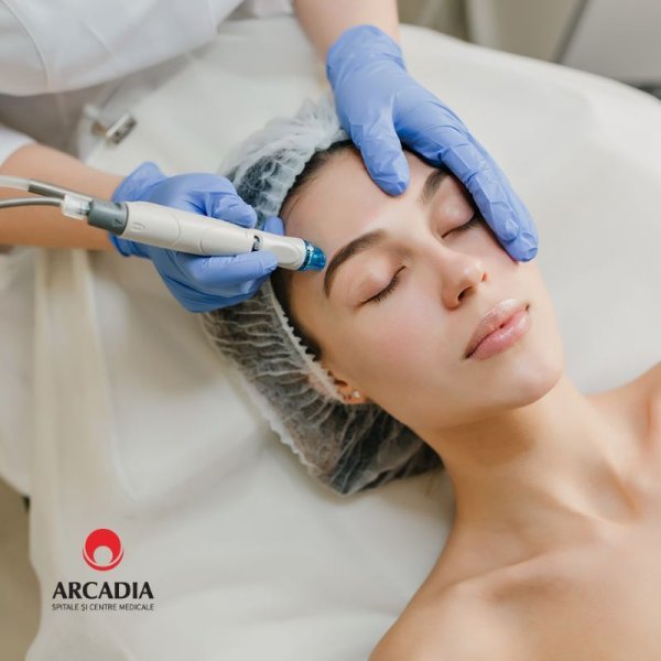  Dermapen, soluție pentru rejuvenare facială și regenerare celulară, la Arcadia Medical Beauty