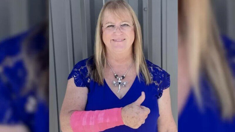  O femeie din Texas a fost atacată de un șoim și de un șarpe în același timp, după ce pasărea a scăpat din greșeală șarpele contorsionat pe ea
