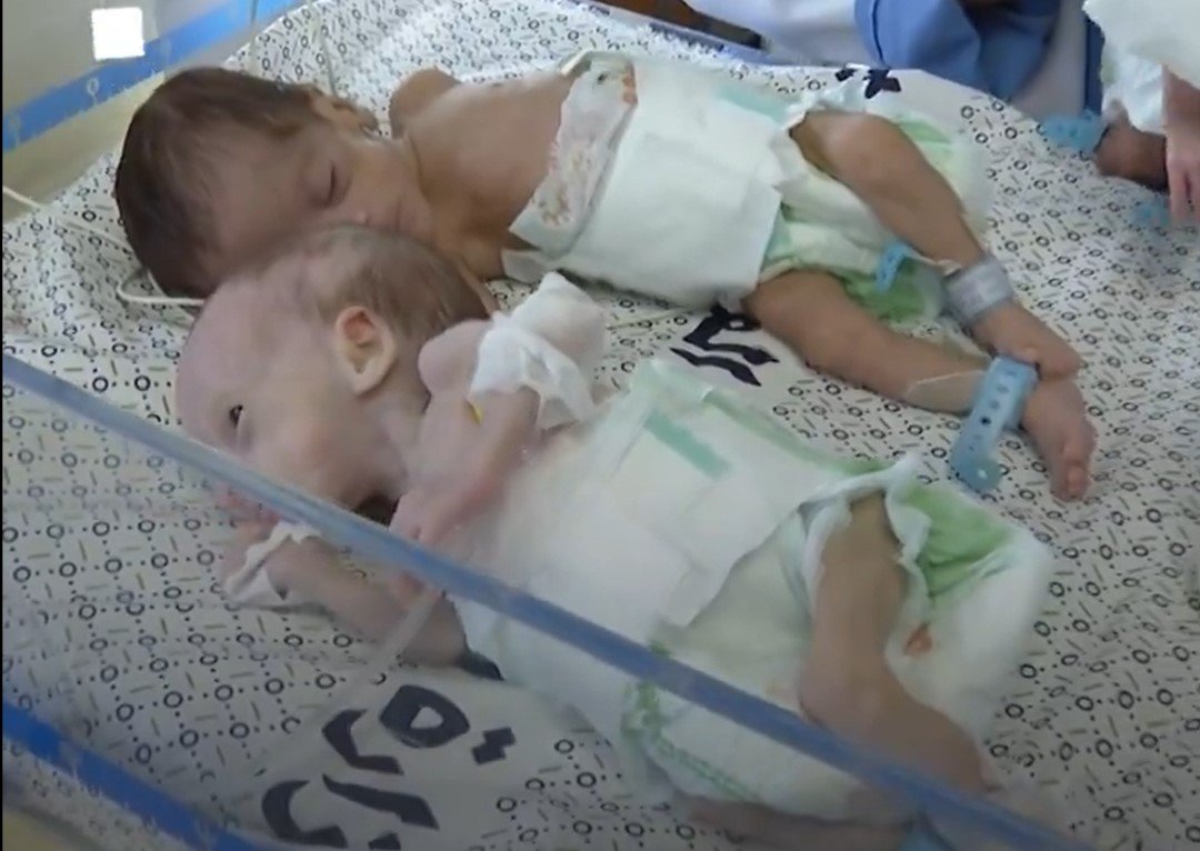  Bebeluşii prematuri evacuaţi din spitalul Al-Shifa au ajuns la graniţa cu Egiptul