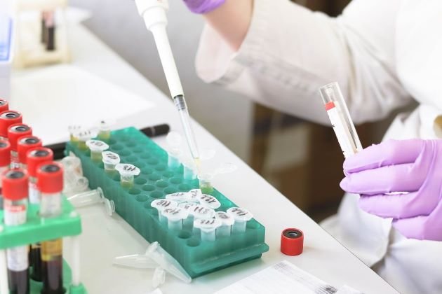  Test rapid pentru HIV și TBC