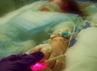  Un copilaş de 4 ani, cu piciorul necrozat, în stare critică la Spitalul „Sfânta Maria”