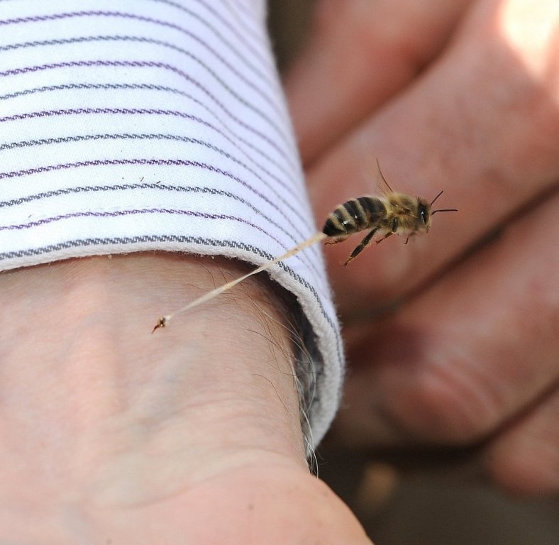  Mort în urma unei înţepături de albină. Ce spun medicii din Iaşi