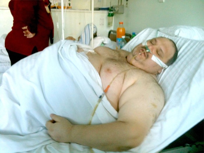  Inginerul de 220 kg din Paşcani a slăbit deja 40 kg după micşorarea stomacului
