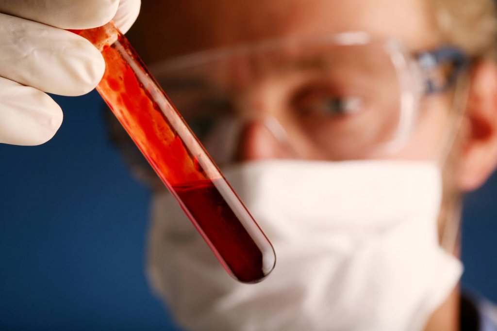  Cercetătorii lucrează la dezvoltarea unui test de sânge ”universal” care ar putea depista cancerul