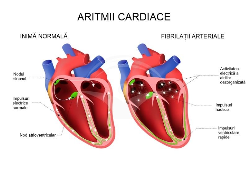  Noi metode de monitorizare a ritmului cardiac